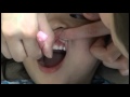 下関市保健部「こころん」歯みがき学ぶ！？の画像